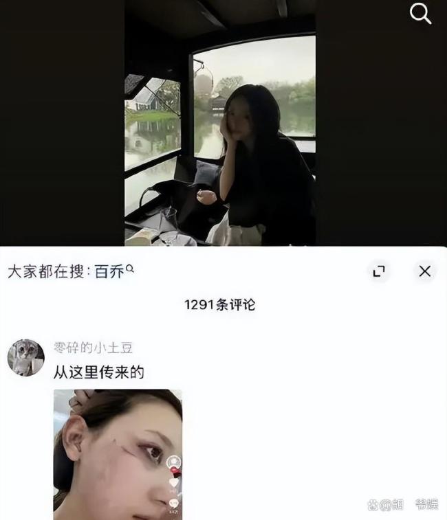 千万网红张百乔再曝婚变,急售别墅引热议