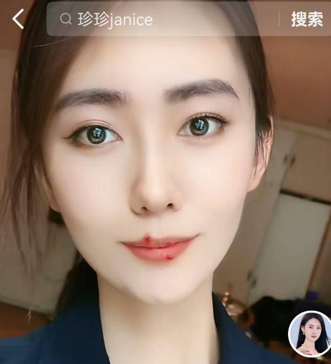 电梯亲吻门后续:宋珍珍自曝19岁被觉得报警没用生死看淡